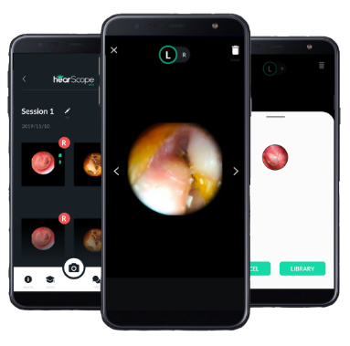 hearScope app for Android devices